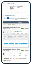 Load image into Gallery viewer, Long Covid19 study - Gut microbiome test
